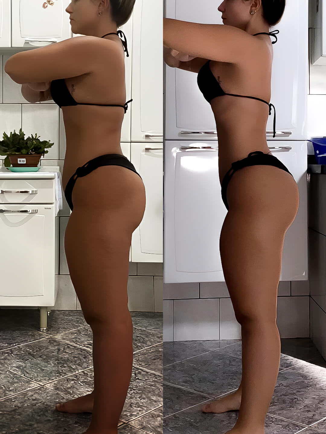 Antes e Depois Flávia